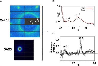 Mapping the Spatial Distribution of Fibrillar Polymorphs in Human Brain Tissue